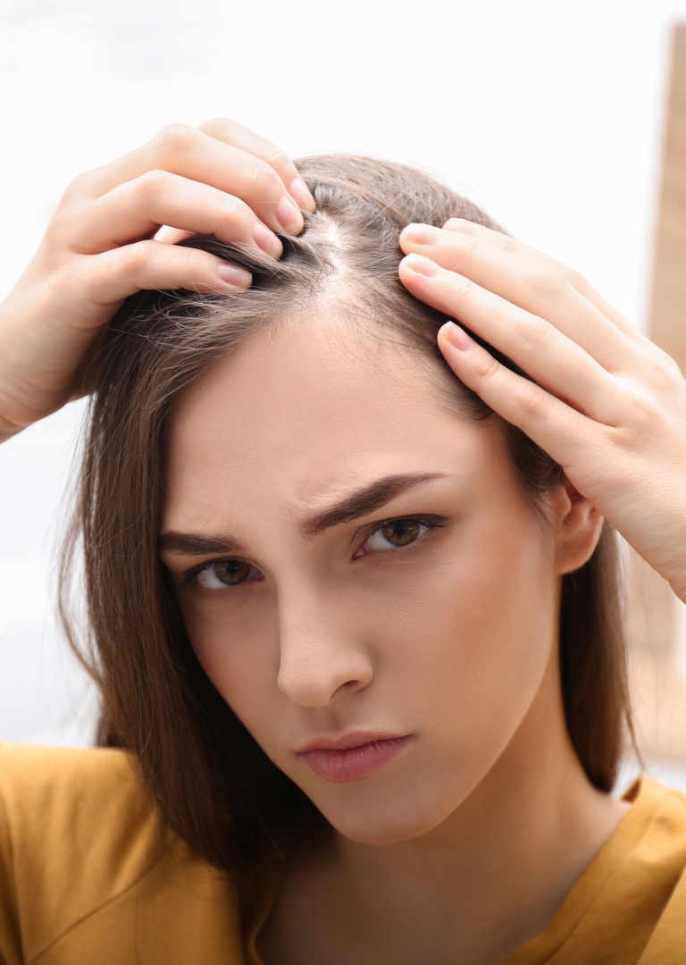 CBD and seborrheic dermatitis: What You Need To Know