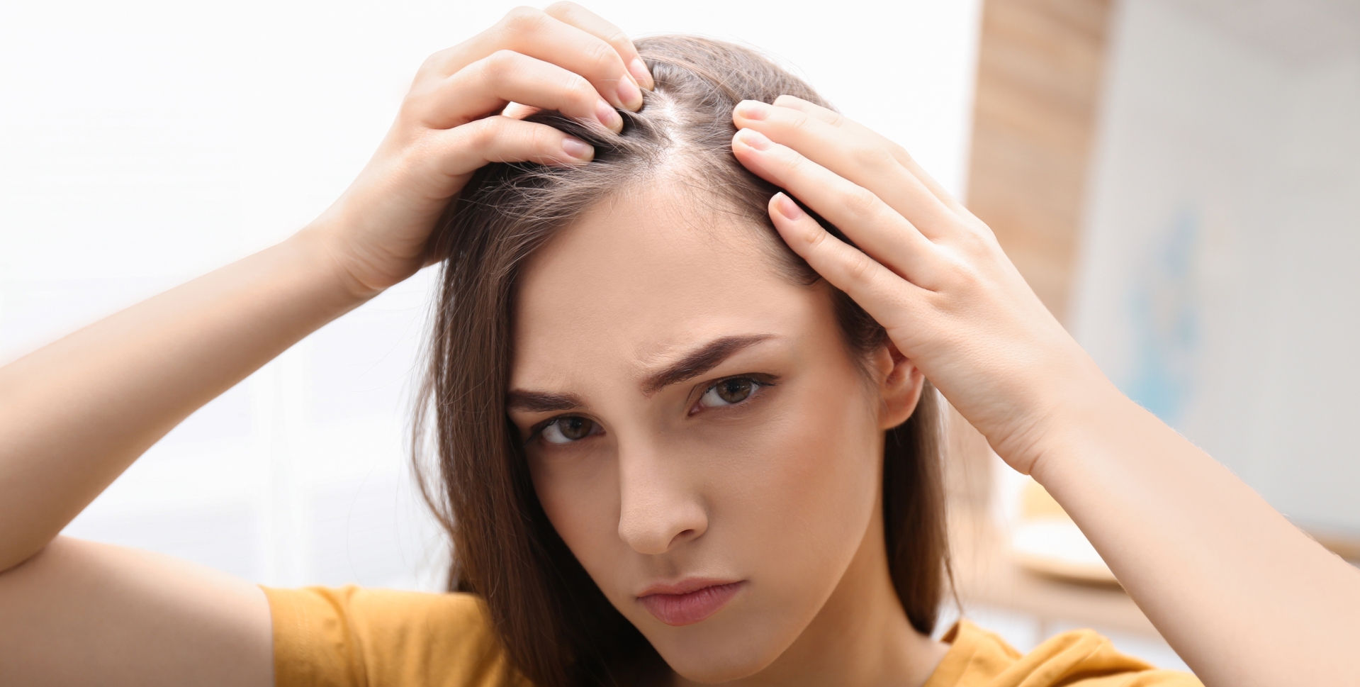CBD and seborrheic dermatitis: What You Need To Know image